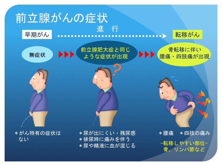 し 骨 癌 転移 やすい