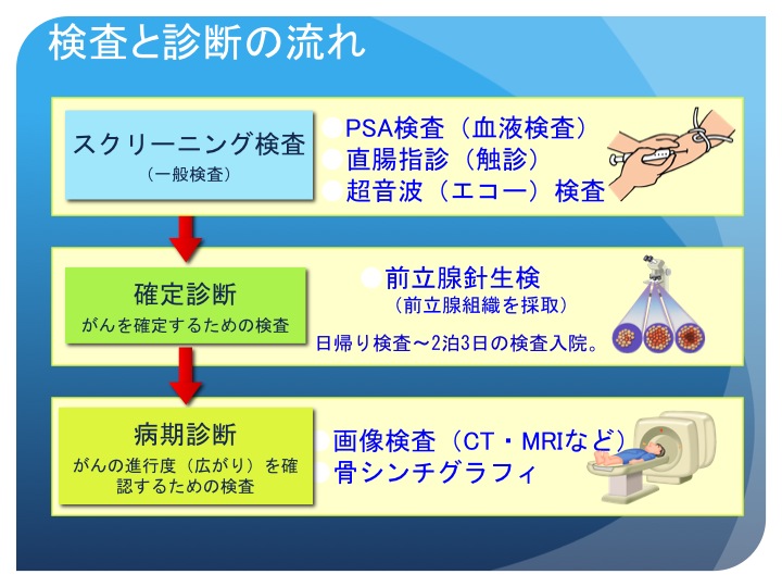 前立腺 癌 検査